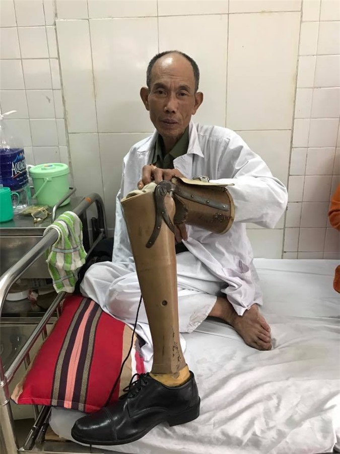 Xem xét khởi tố vụ thương binh bị hành hung ở Chương Mỹ