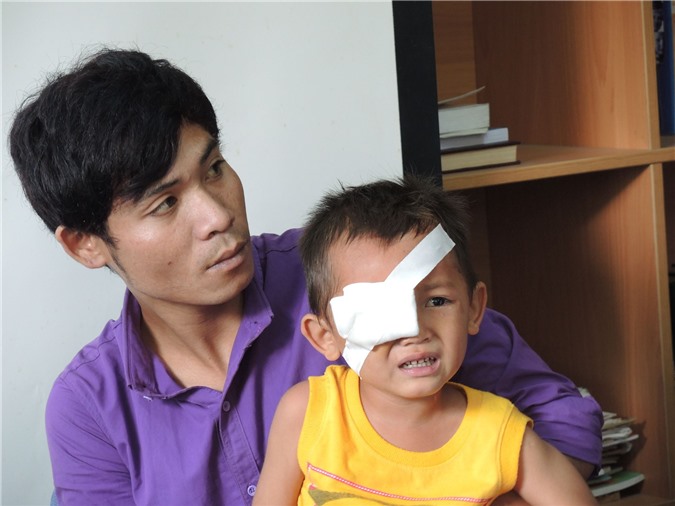 Chơi súng tự chế, bắn đạn bi "găm" trúng hốc mắt bé 3 tuổi