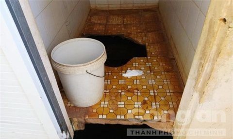 Bé 5 tuổi chấn thương sọ são sau khi đi vệ sinh 