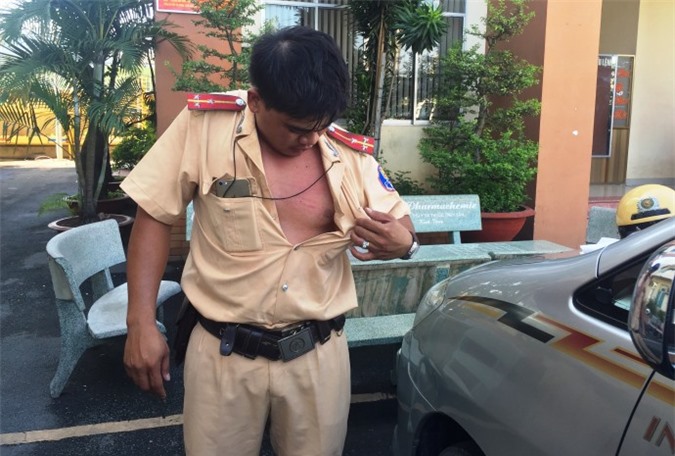 Tự rạch tay chảy máu, thanh niên nhiễm HIV tấn công CSGT