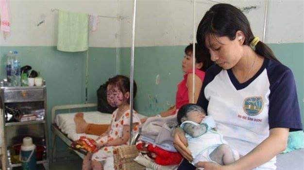 Dịch thủy đậu bùng phát, lây lan nhanh chóng mặt