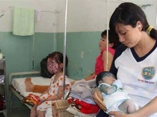 Dịch thủy đậu bùng phát, lây lan nhanh chóng mặt