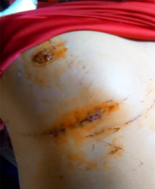 Khởi tố vụ chém nhau kinh hoàng tại Đắk Lắk