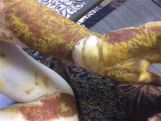 Vụ nổ phòng thực hành Hóa: Kỷ luật hiệu trưởng