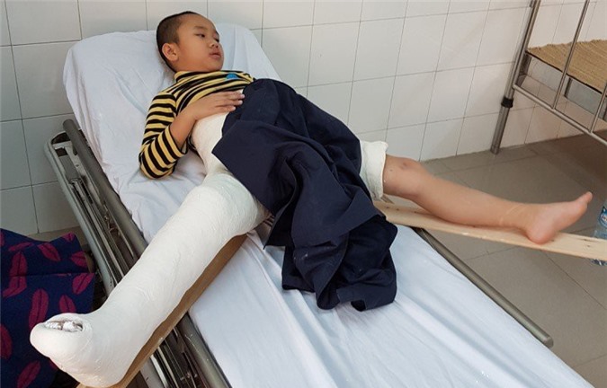 Học sinh gãy chân ở trường được đưa đi giám định