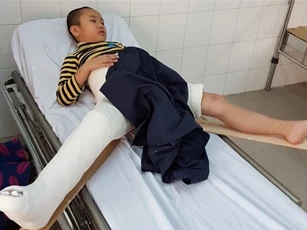 Học sinh gãy chân ở trường được đưa đi giám định