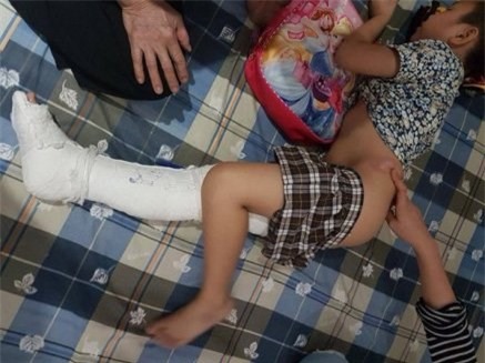 Học sinh gãy chân trong trường: Lái xe có chịu trách nhiệm?