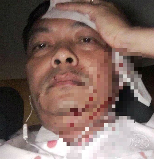 Giám đốc nhân sự cà phê Trung Nguyên bị đánh nhập viện