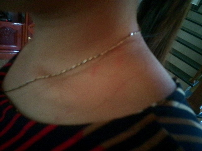 Truy bắt kẻ chích điện chủ quán cà phê, giật dây chuyền vàng