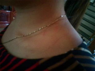 Truy bắt kẻ chích điện chủ quán cà phê, giật dây chuyền vàng