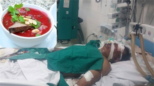 Ăn tiết canh lợn, người đàn ông hoại tử hết chân tay