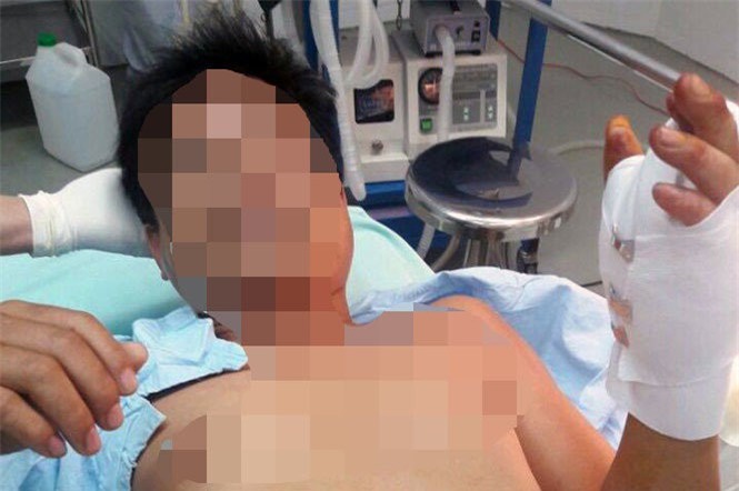 Nhặt được vật nghi là súng bút, thanh niên bị đạn xuyên thủng tay