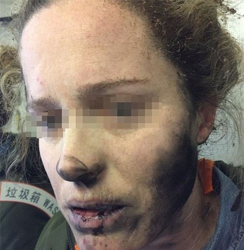 Hành khách cháy xém mặt vì tai nghe trên máy bay phát nổ 