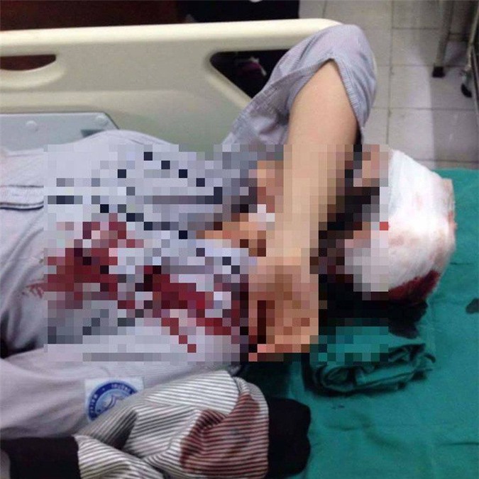 Sở GD&ĐT Hà Nội yêu cầu điều tra vụ nữ sinh bị đánh trọng thương