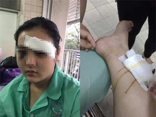 Tin mới nhất vụ cô gái 16 tuổi bị côn đồ hành hung