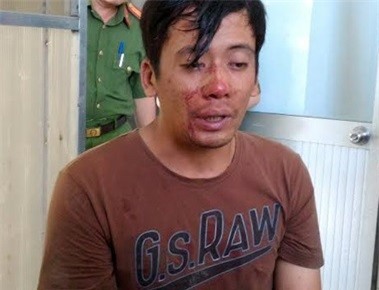 Giật dây chuyền vàng rồi dùng hung khí chống trả