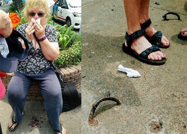 Bồi thường 1.000 USD cho du khách ngã "dập mặt" vì móc sắt