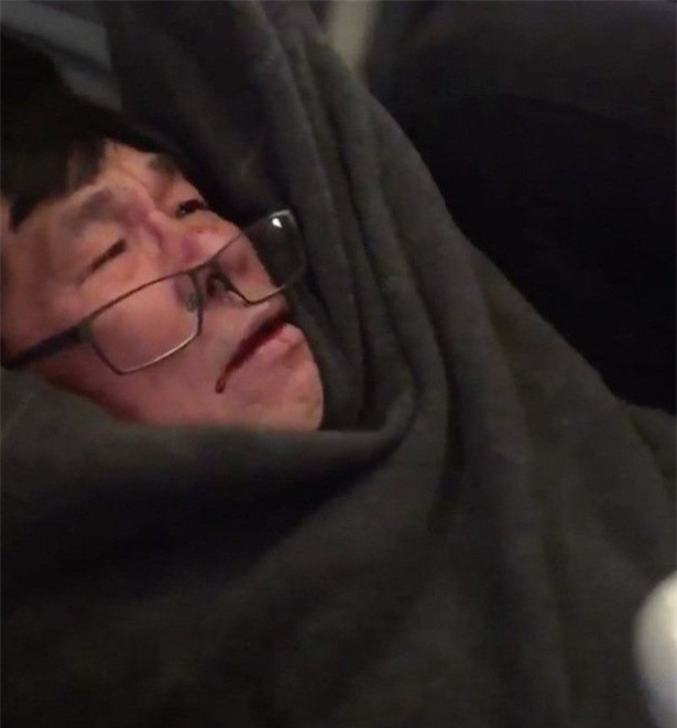 Hành khách bị lôi khỏi máy bay: Ông Trump quan tâm, dân Mỹ sục sôi 