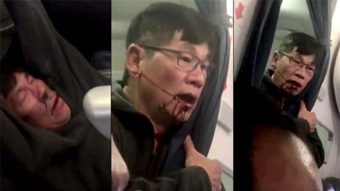Khách gốc Việt bị lôi khỏi máy bay: CEO United Airlines nói gì?