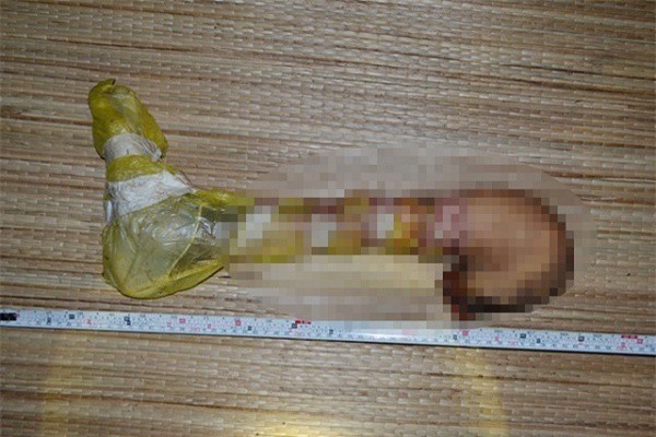 Xác định nguồn gốc chân người trong bãi rác ở Trà Vinh