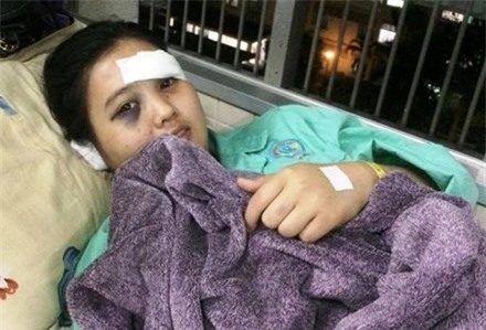 Báo cáo Thủ tướng vụ thiếu nữ bị cắt tai giữa Sài Gòn