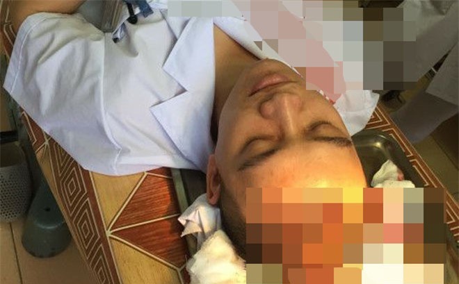 Bác sĩ bệnh viện đa khoa Thạch Thất bị đánh bất tỉnh