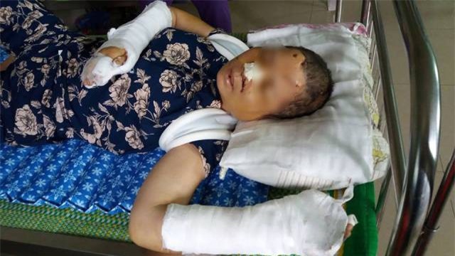 Chồng cuồng ghen đánh vợ rồi cắt tay tự tử