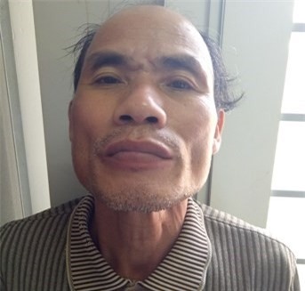 Đâm người 5 nhát, "gã điên" cố thủ bằng xô đầy xăng và dao nhọn