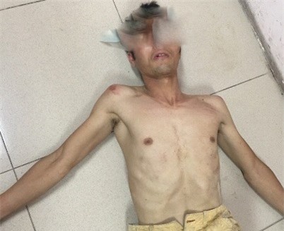 Giải cứu cô gái bị khống chế, trói tay ở nhà nghỉ tại Hà Nội