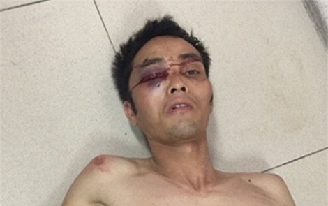 Giải cứu cô gái trẻ bị khống chế trong nhà nghỉ ở Hà Nội