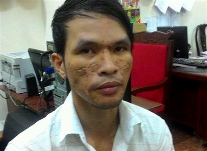 Kẻ hành hạ bé trai Campuchia bị truy tố đến 3 năm tù