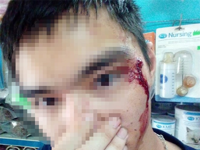 Grab lên tiếng về nghi vấn tài xế đánh người vì không nhường đường