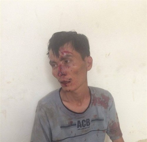 Thanh niên cầm dao truy sát nhiều người đi đường ở Hà Nội