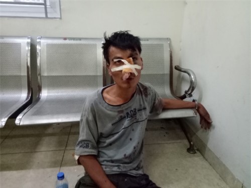 Tình tiết bất ngờ vụ thanh niên cầm dao chém nhiều người trên phố