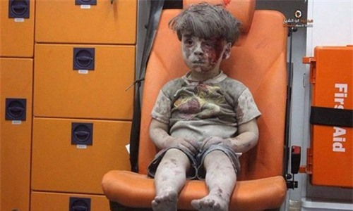 Sự thật về hình ảnh cậu bé “biểu tượng chiến tranh Syria”