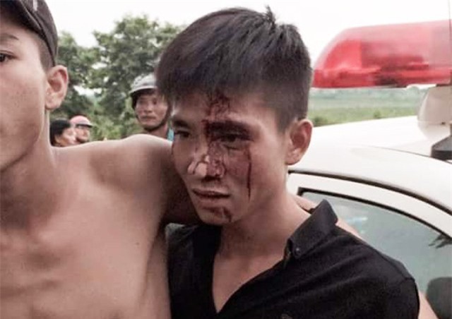 Xác minh thanh niên chảy máu đầu khi mâu thuẫn với công an