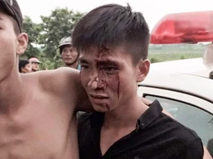 Xác minh thanh niên chảy máu đầu khi mâu thuẫn với công an
