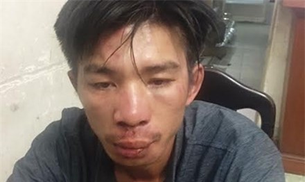 Lừa thiếu nữ vào khách sạn bằng "hợp đồng tình ái" 150 triệu