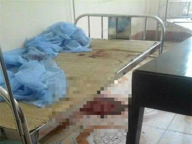 Chồng trút "mưa dao" chém vợ tử vong ở bệnh viện