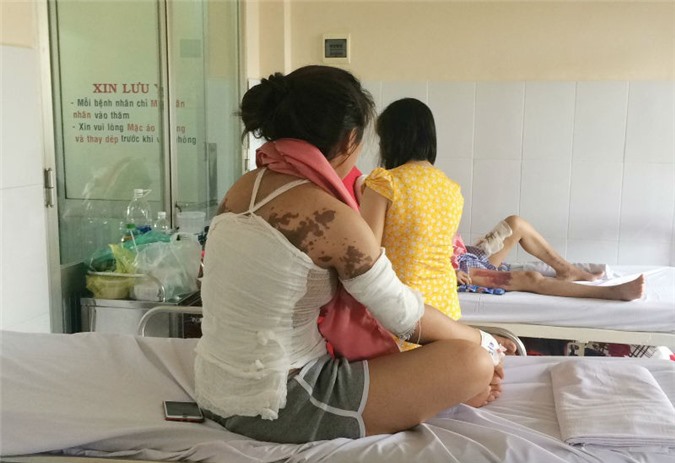 Tạt axit ở Đồng Nai: Một cô gái bỏng nặng, nguy cơ hỏng mắt