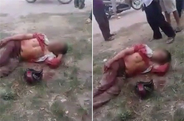 Nghệ An: Tài xế xe ôm bị cướp đâm, lết ra đường kêu cứu