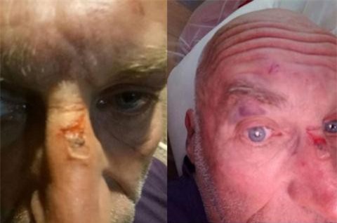 Nhóm thanh niên đánh ông Tây ở Sa Pa: Thông tin bất ngờ