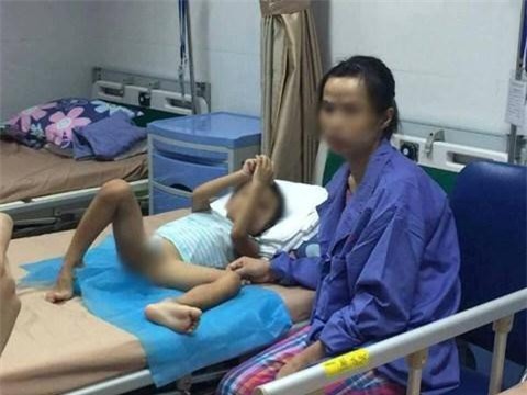 Hàng loạt trẻ mắc sùi mào gà: Thông tin mới nhất