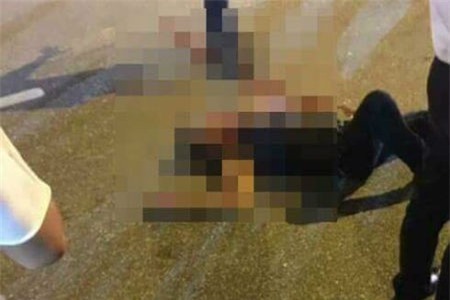 Truy sát trong đêm, một thanh niên bị chém trọng thương