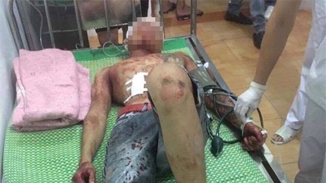 30 côn đồ vác hung khí truy sát người trong đêm