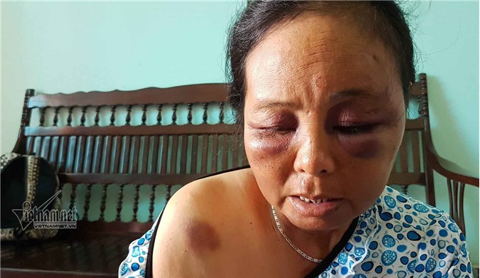 Bị đánh vì nghi bắt cóc trẻ em: Nạn nhân kể phút kinh hoàng