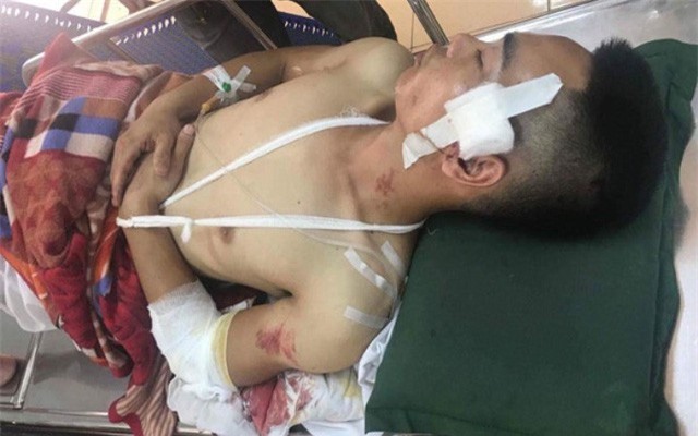 Công an thông tin chính thức vụ 2 nhóm thanh niên truy sát ở Hải Dương 