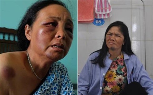 Bị đánh nghi bắt cóc trẻ em ở Sóc Sơn: 2 nạn nhân đi giám định thương tật