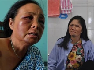 Bị đánh nghi bắt cóc trẻ em ở Sóc Sơn: 2 nạn nhân đi giám định thương tật