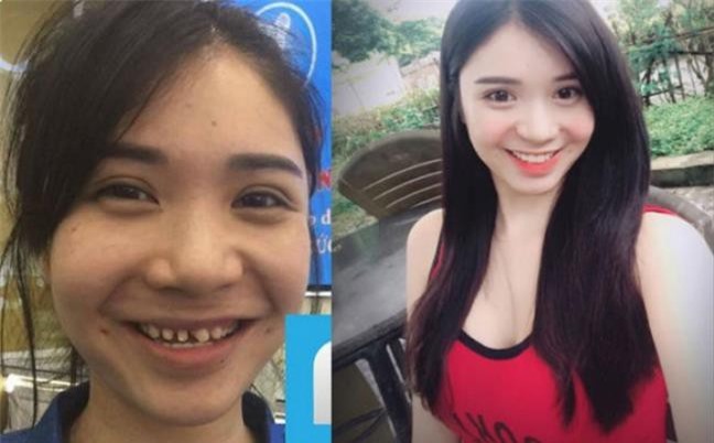 Phủ nhận phẫu thuật thẩm mỹ, Thanh Bi lộ ảnh "đập mặt xây lại"